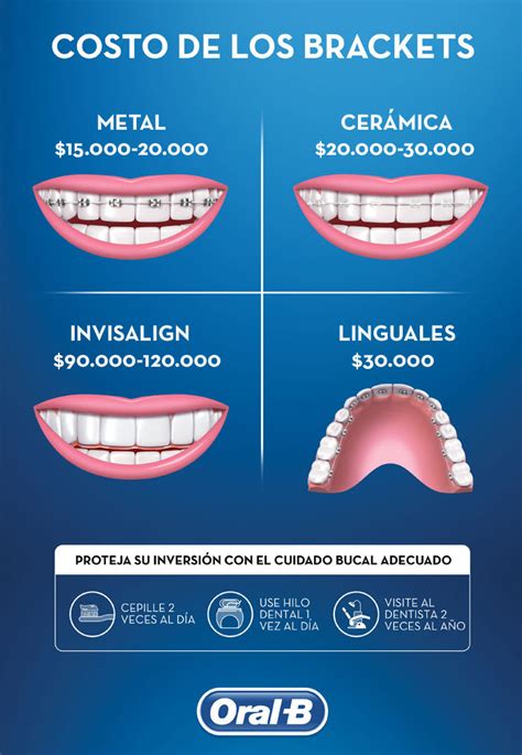 precios brackets metalicos|cuanto cuesta un bracket.